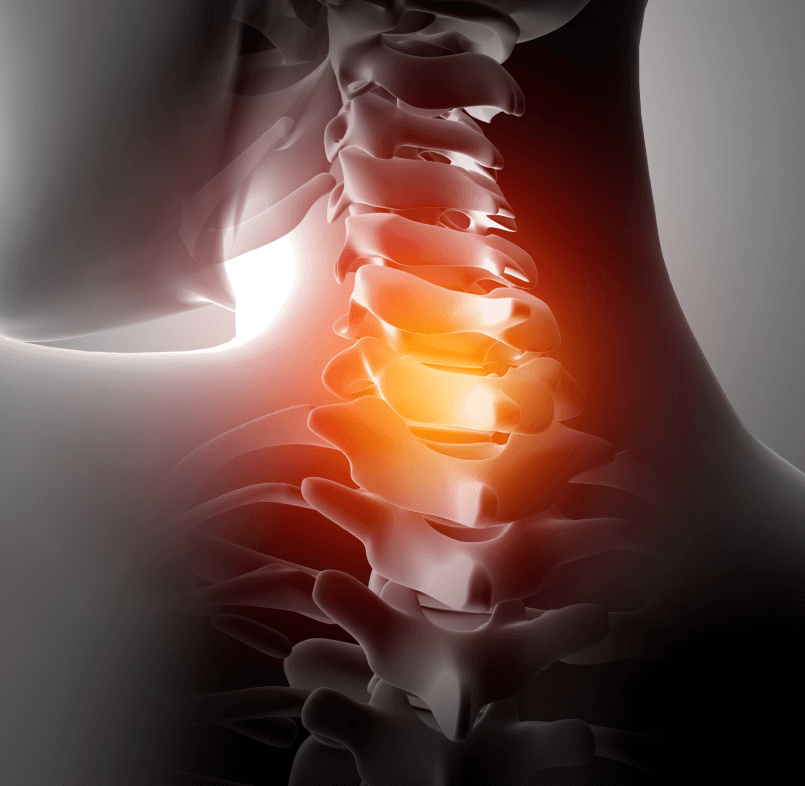 Spine surgery Spine surgery