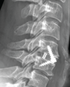 Surgery 1 neurosurgical services